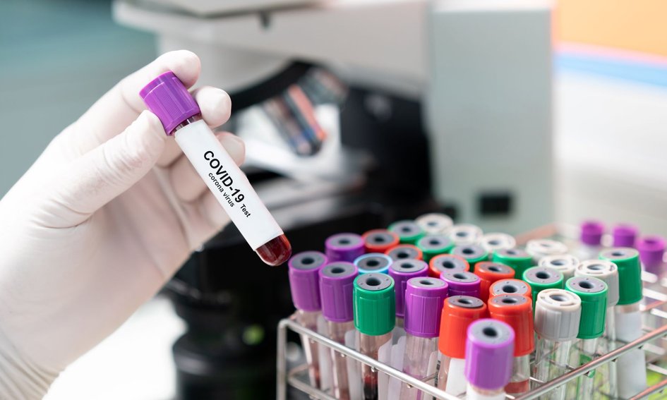 W Austrii ruszają masowe testy na obecność koronawirusa