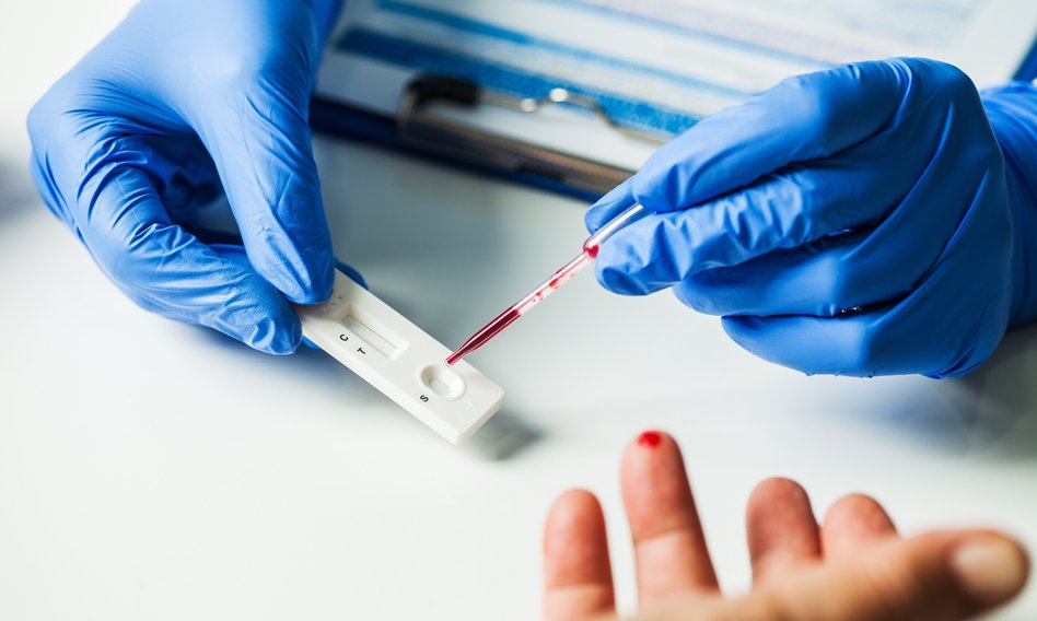 Test na Covid-19 online. Sprawdzamy, jak otrzymać skierowanie