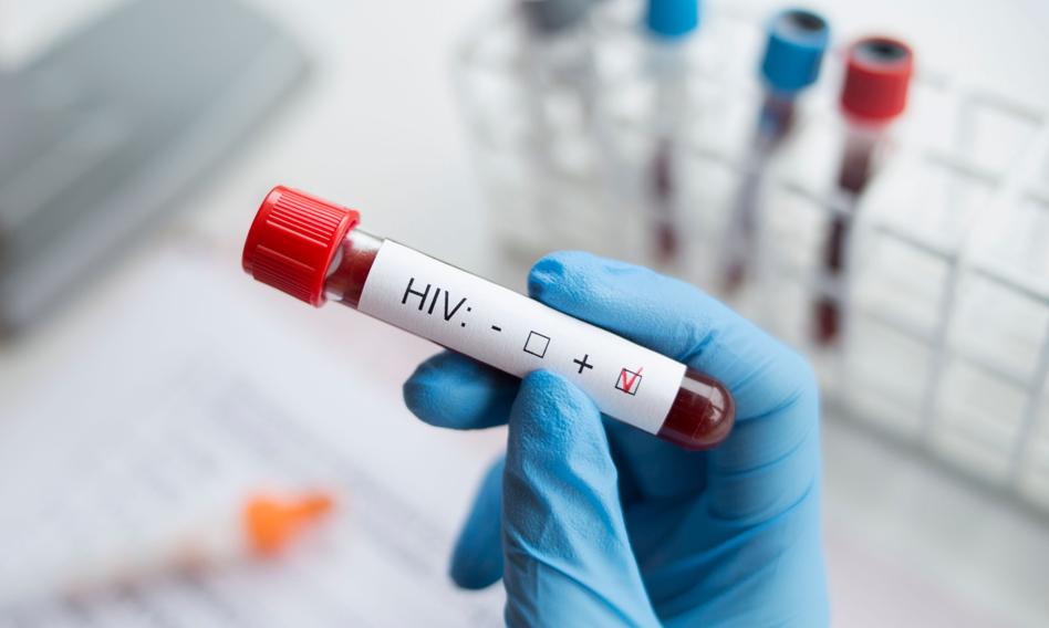 MZ planuje zmiany w programie walki z HIV i AIDS. Kluczowa rola przypadnie samorządom